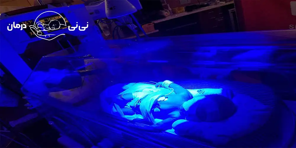 انواع لامپ دستگاه زردی نوزاد
